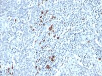 Formalin-fixed, paraffin embedded human tonsil sections stained with 100 ul anti-Kappa Light Chain (clone TB28-2) at 1:200. HIER epitope retrieval prior to staining was performed in 10mM Citrate, pH 6.0.